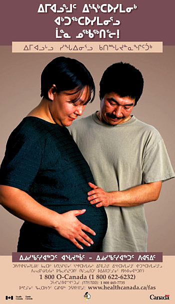 STOP Fetal Alcohol Syndrome